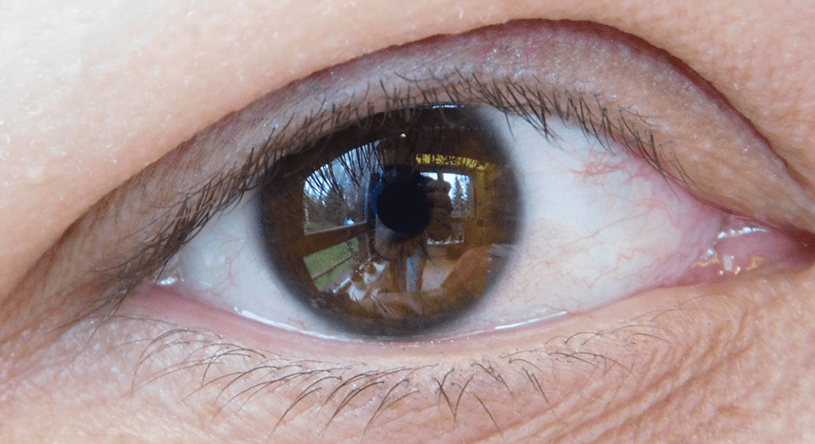 Ojo donde se refleja una figura humana ubicada en un espacio con ventanas