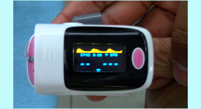 Pulse oximeter
