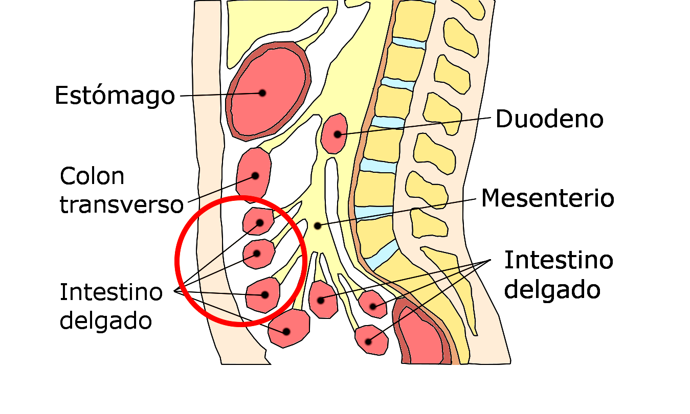 Ubicación de la colocación del catéter de DP