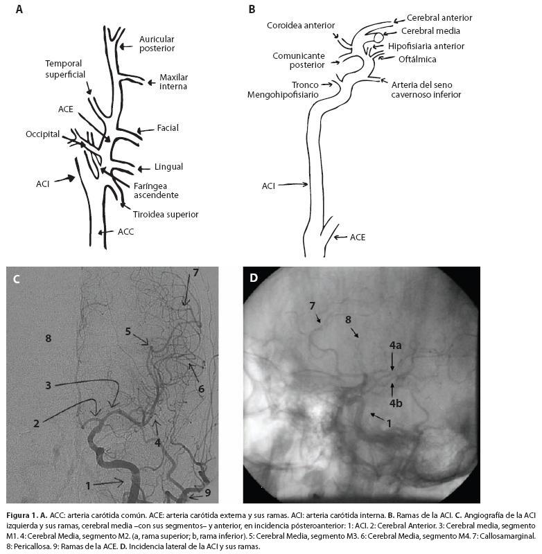Esquema de la arteria carótida
