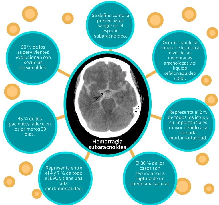 Datos sobre la hemorragia subaracnoidea