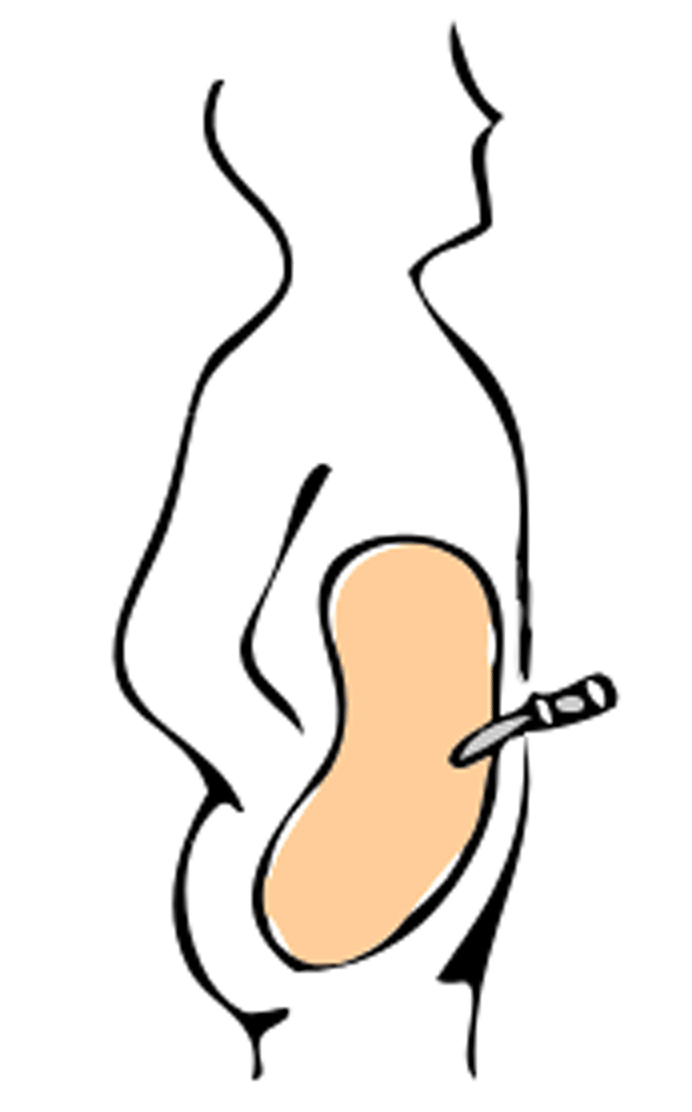 Peritoneal Dialysis Method