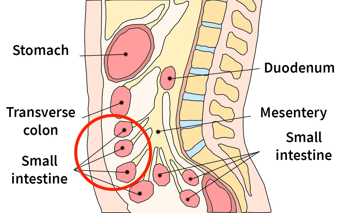 Peritoneal dialysis system on patient