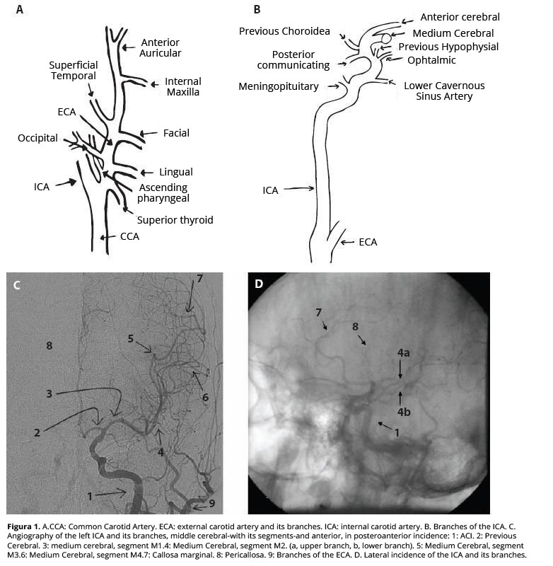Diagram of the carotid artery