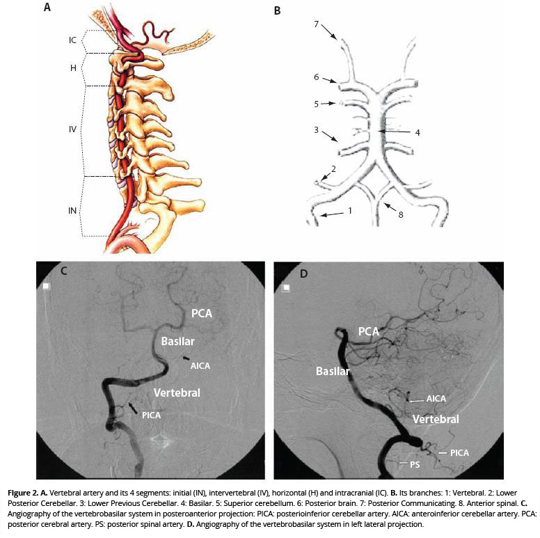 Vertebro-basilar system (Poveda, 2009)