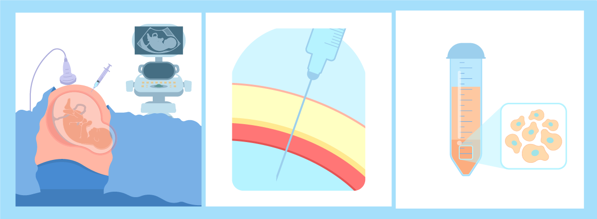 Tipos de pruebas y diagnósticos prenatales para la detección de problemas de defectos del tubo neural